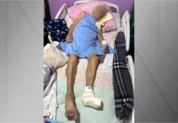 Horror: Idosa de 103 anos tem pé amputado sem anestesia em casa